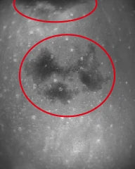 SWIR 1550 nm：境界が明確な2つの暗い打撲痕（テスターによりマーク済み）。